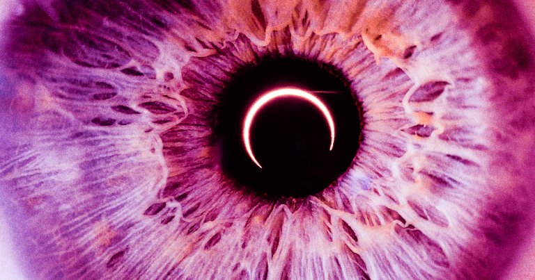 A young woman's eyes became permanently damaged after she looked at a solar eclipse without proper eye protection.