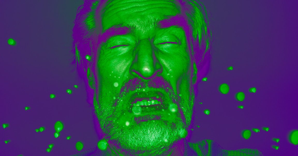 A man in Florida had such an epic sneeze that he pushed his guts outside his body after he had surgery 15 days ago.