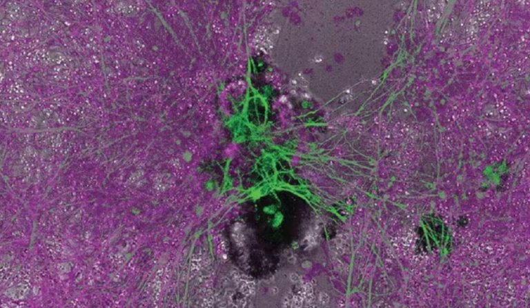 Biological robots such as xenobots and anthrobots perform new functions that their cells originally never exhibited.