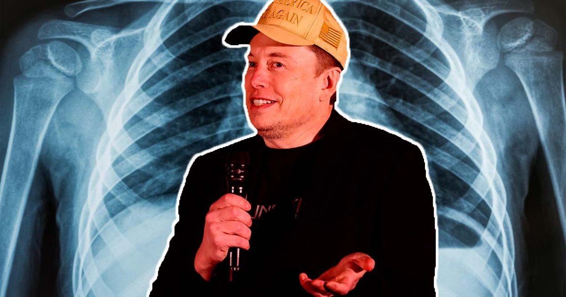 Grok now has image understanding capabilities, and to test and improve, Elon Musk wants you to feed it medical documents.