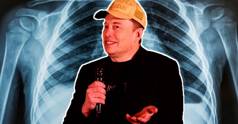 Grok now has image understanding capabilities, and to test and improve, Elon Musk wants you to feed it medical documents.