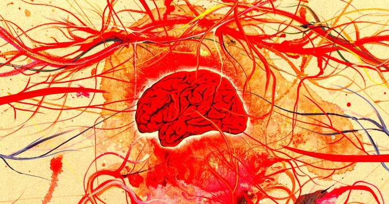 Scientists tracked tiny pieces of microplastics as they moved through the brain blood vessels of mice. Some of them became stuck.