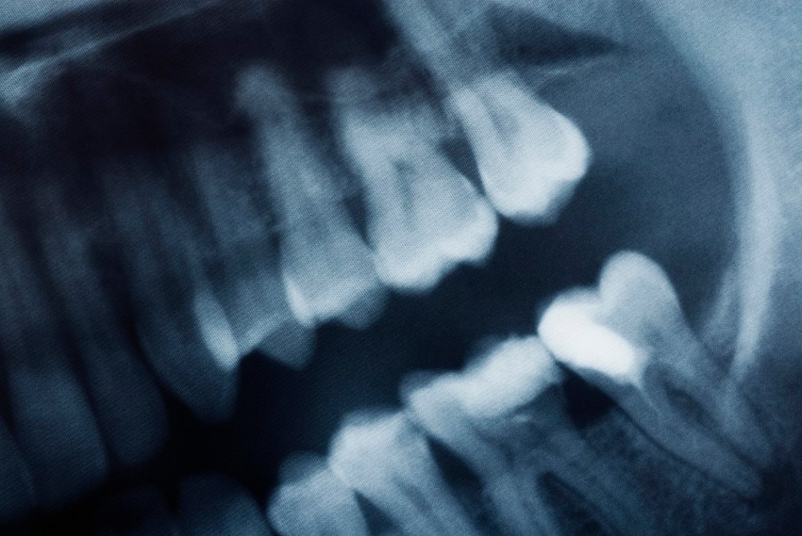 Like something out of "Little Shop of Horrors," scientists have managed to grow human-like "replacement teeth" in a lab.