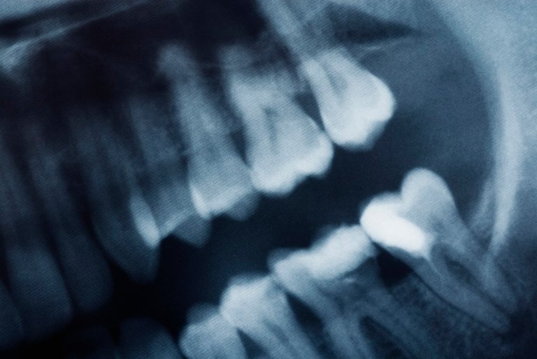 Like something out of "Little Shop of Horrors," scientists have managed to grow human-like "replacement teeth" in a lab.