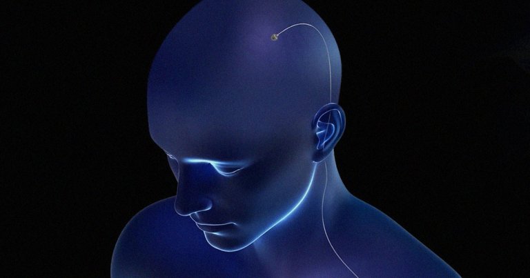A brain-computer interface startup called Paradromics is partnering with Saudi Arabia's megalomaniac Neom city-building project.