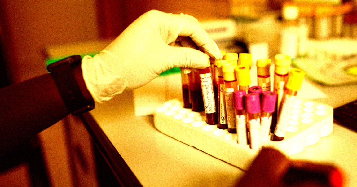 Billionaire Elon Musk's assault on USAID is already proving devastating for ongoing, life-saving research, including HIV vaccine trials.