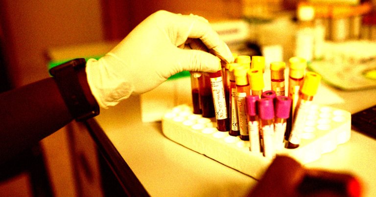 Billionaire Elon Musk's assault on USAID is already proving devastating for ongoing, life-saving research, including HIV vaccine trials.