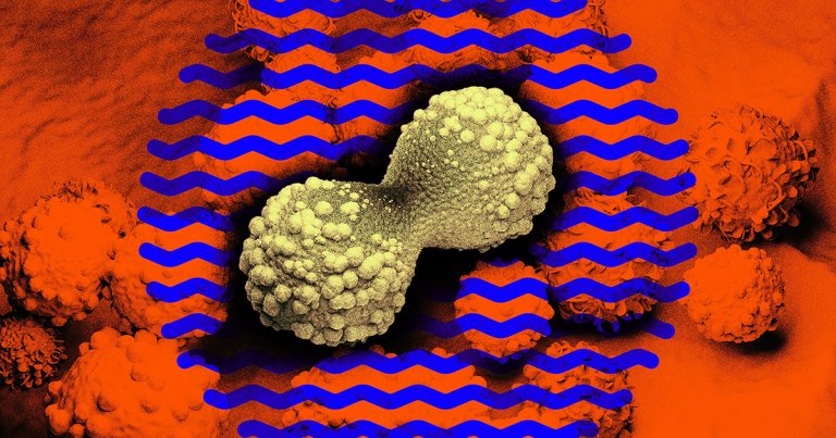 With the help of mRNA technology proven effective during the COVID era, researchers are now closer than ever to creating cancer vaccines.