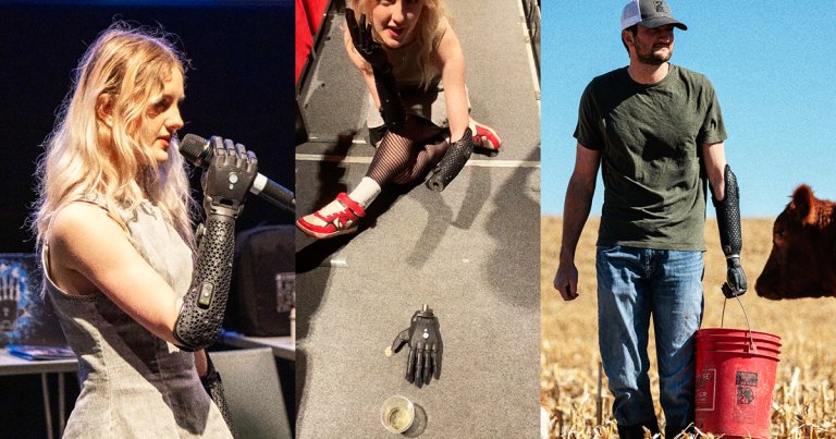 The world's first wireless bionic hand, built by Open Bionics, can be fully detached and operate on its own.