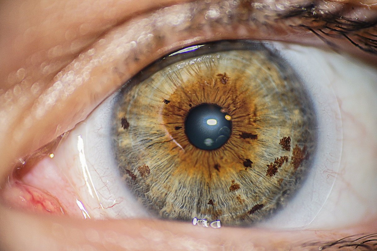 Doctors Say Injecting Gold Into Eyeballs Could Restore Lost Vision
