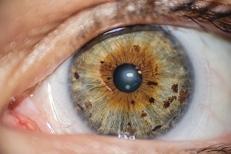 Gold particles could help reproduce the visual signals of damaged photoreceptor cells and restore vision, according to new research.