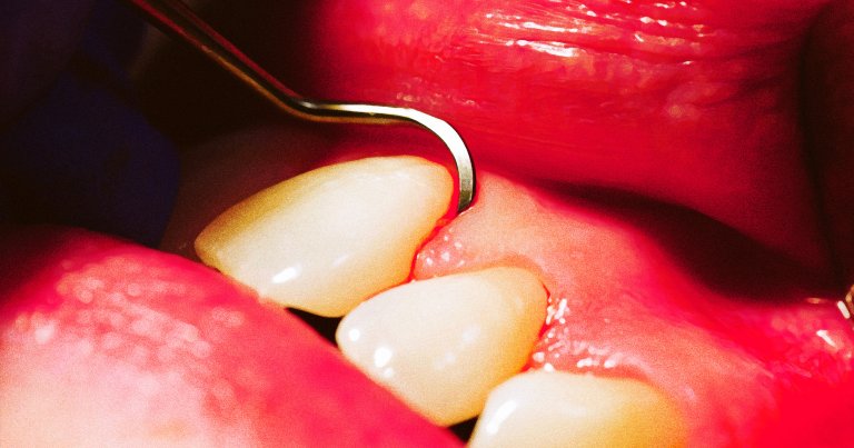 Concerns are growing that private equity-led dental companies are pressuring patients into unnecessary treatments, with dangerous results.