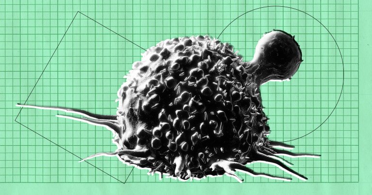 AI cancer detection has been touted as being as good as or better than doctors — but now, it seems that it has atrophied doctors' brains.