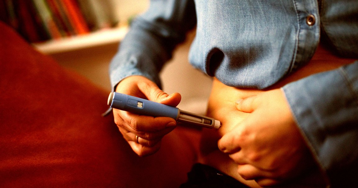 Scientists say they've come up with a way for the body to produce its own store of glucagon-like peptide-1 (GLP-1).