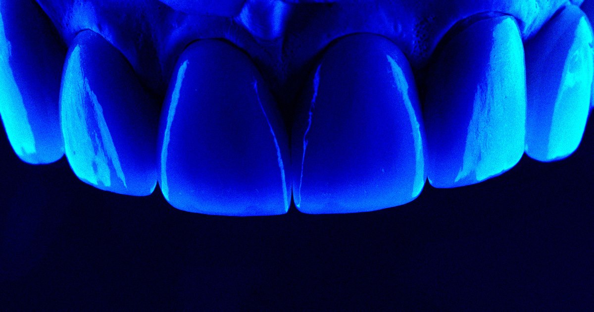 Scientists Say They've Figured Out a Way to Regrow Tooth Enamel