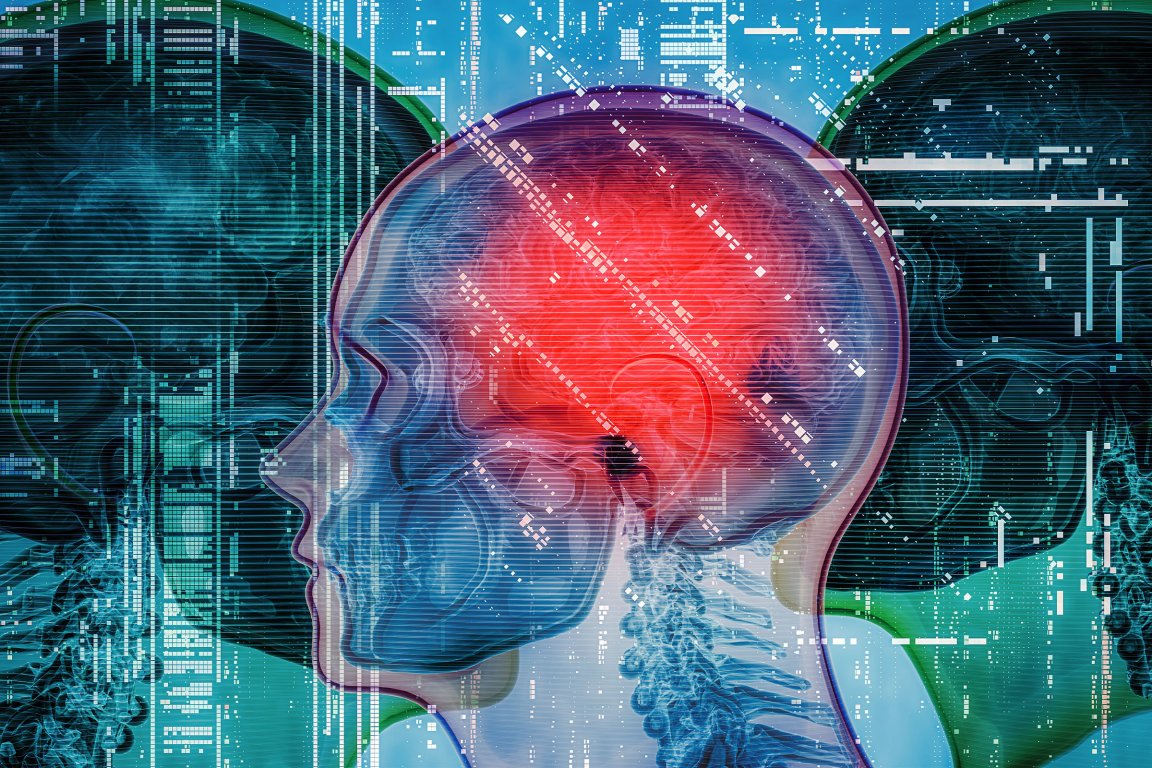 A man paid about $2,500 for a whole body MRI scan that came up healthy, but he then suffered a massive stroke less than a year later.