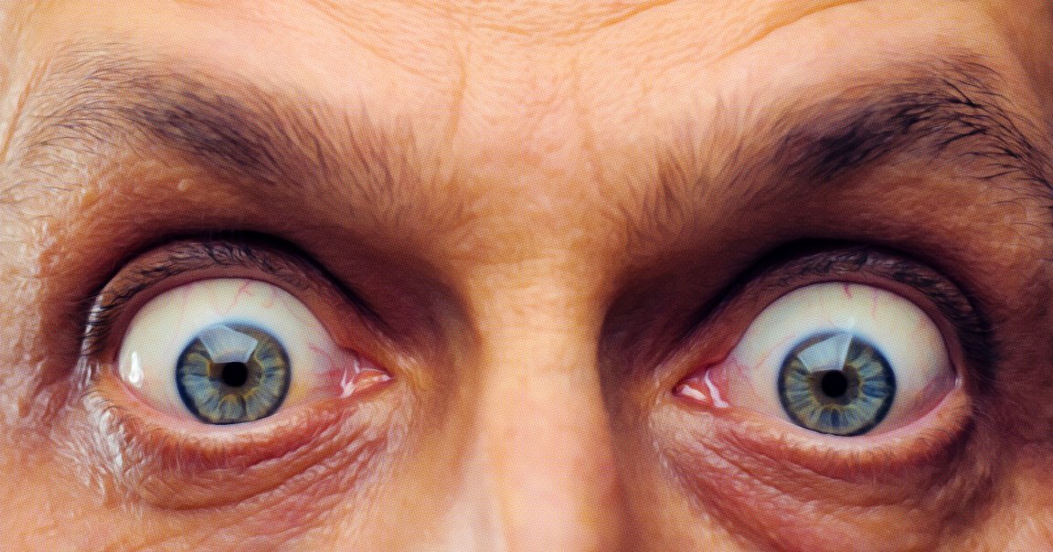 Close-up of wide-open blue eyes with visible blood vessels, surrounded by wrinkled skin and dark eyebrows.