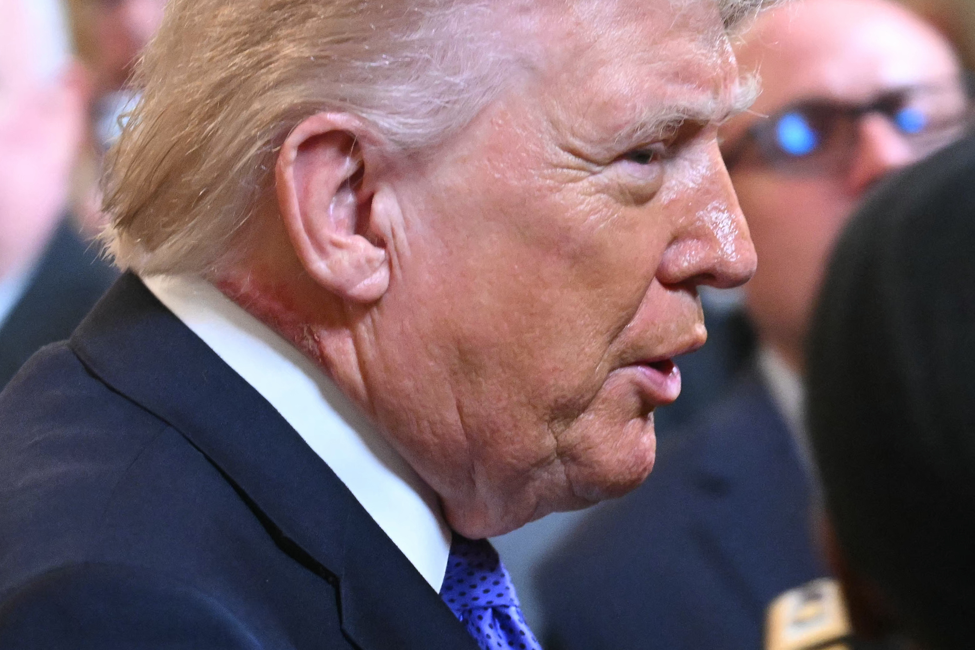 White House Responds as Scabby Mark Appears on Trump’s Neck 2 A profile view of Donald Trump shows a scabby mark on his neck, partially obscured by the collar of his shirt.