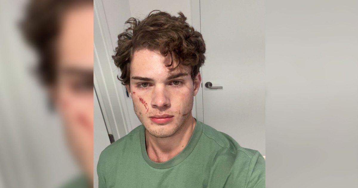 Clavicular Rushed to Hospital in Perfect Illustration of Why Looksmaxxing Is a Deadly Death Cult