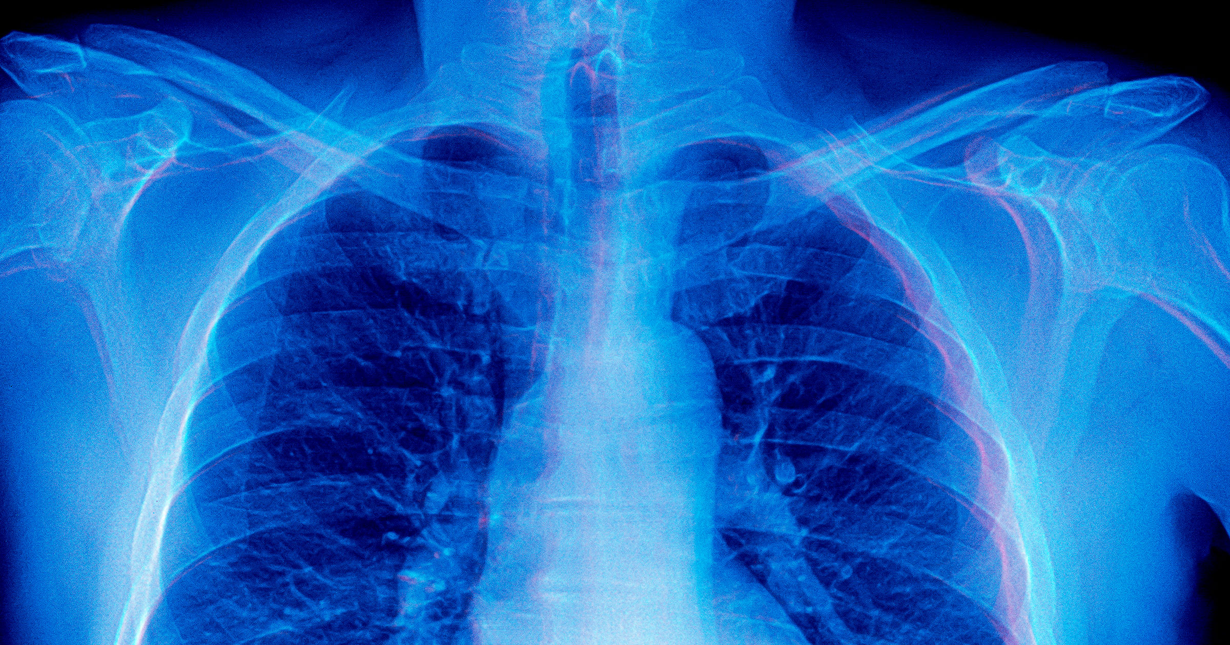 futurism.com - Victor Tangermann - Frontier AI Models Are Doing Something Absolutely Bizarre When Asked to Diagnose Medical X-Rays