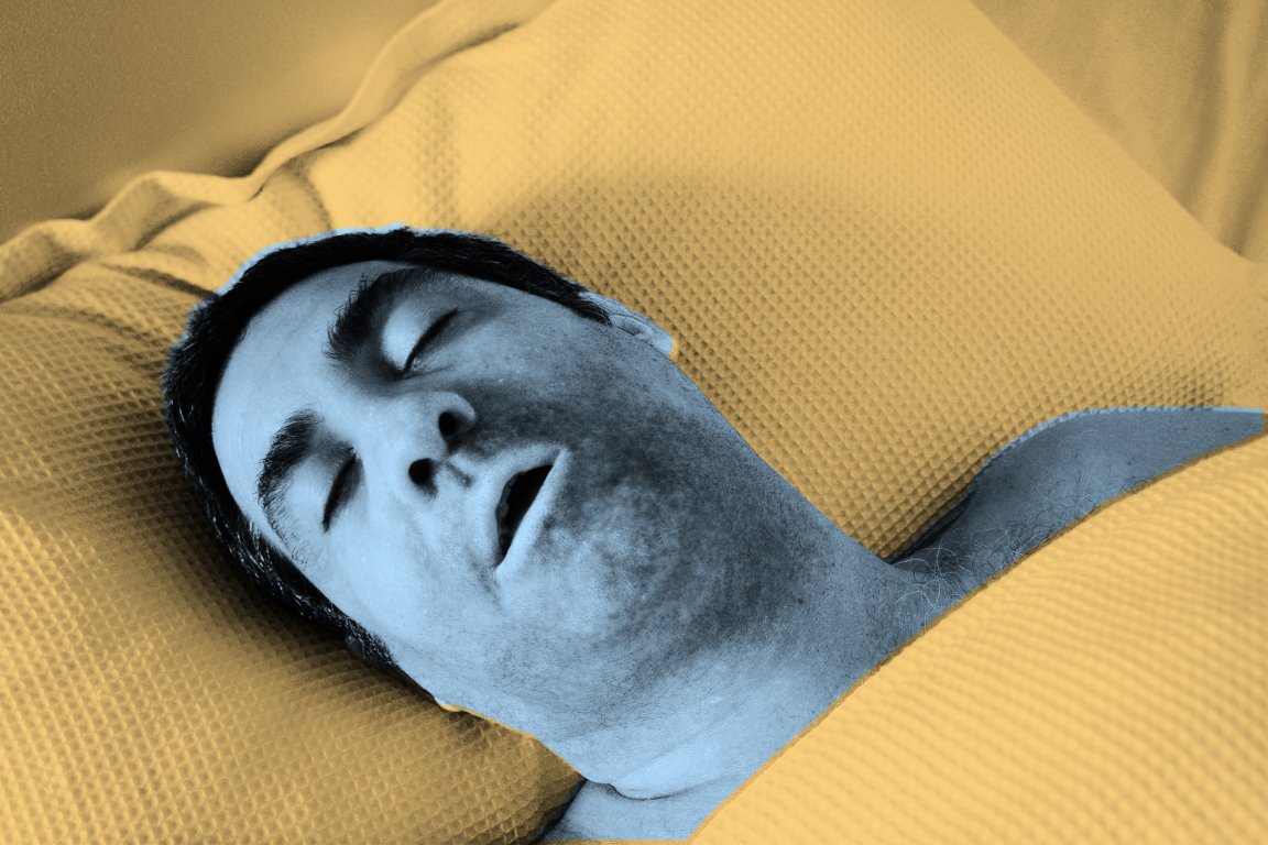 A photograph of a man asleep in bed that has been color-treated to make him appear blue and possibly dead, set on a field of light yellow in an off-set screenprint style.