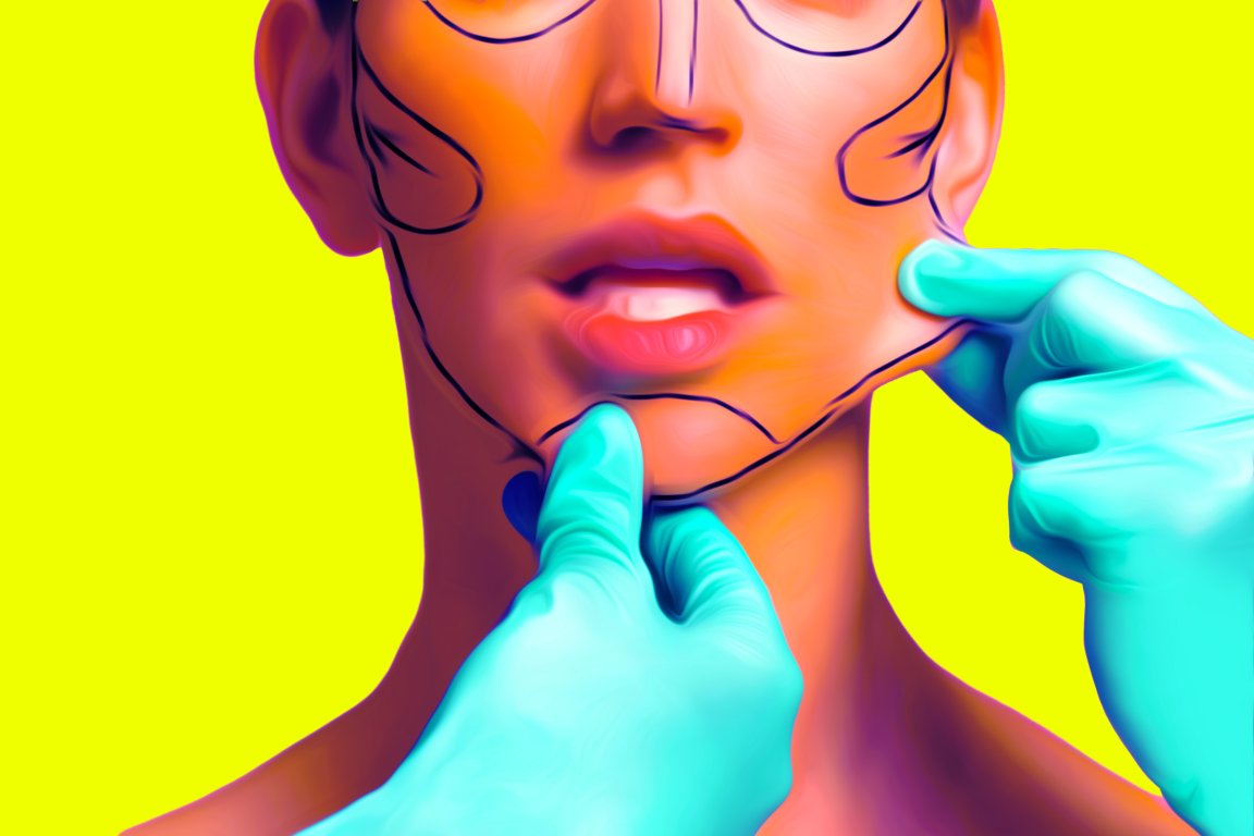 Close-up of a person's lower face and neck with black surgical markings outlining areas on the cheeks and chin, manipulated so that it looks like an AI generation. Two hands wearing blue medical gloves are gently pinching the skin on the chin and cheek. The background is bright yellow.