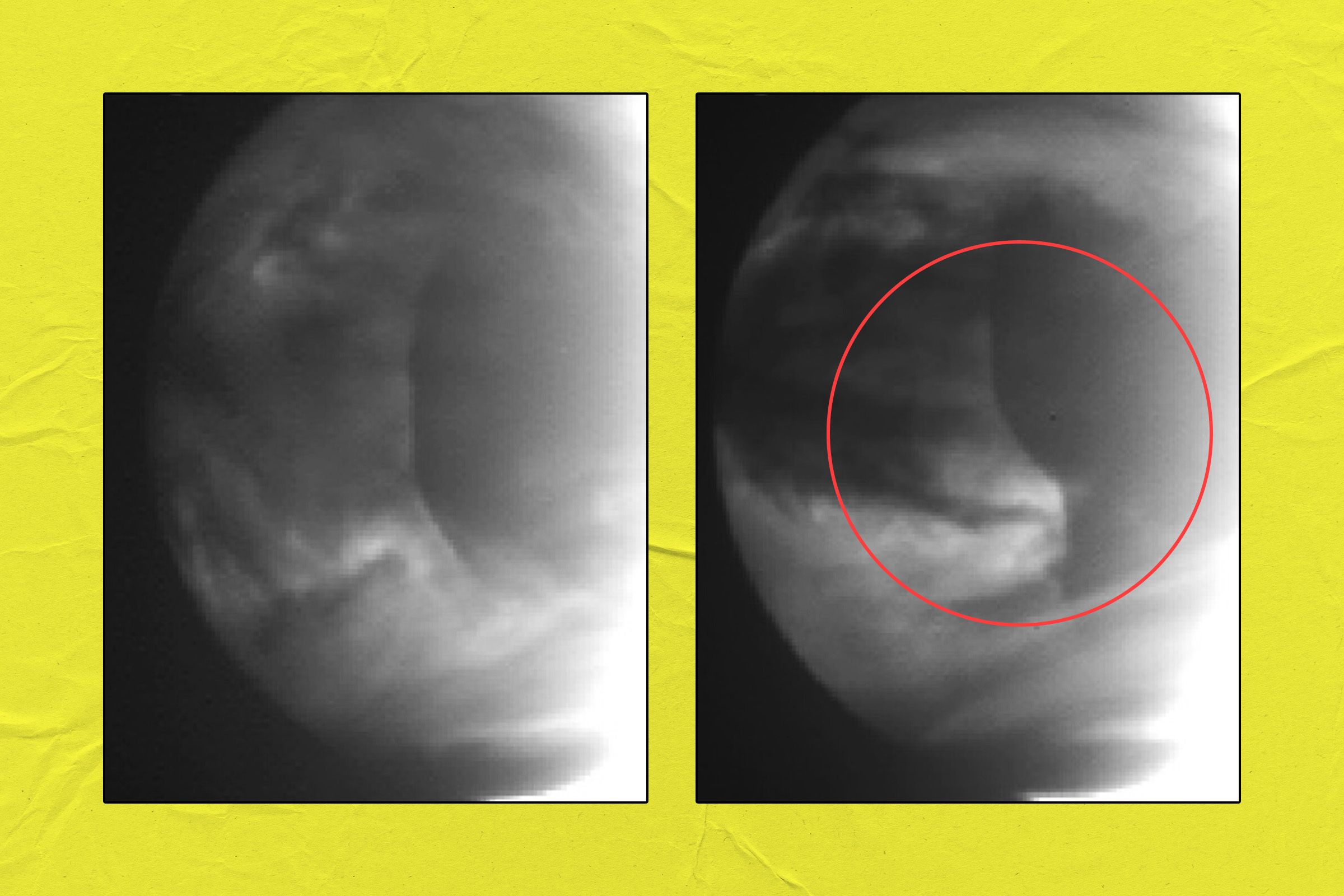 Scientists Detect Weird Anomalies in Clouds of Venus