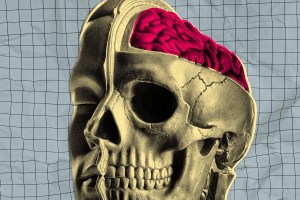 Illustration of a man's head with a cross-section revealing his skull and a further cross-section revealing a portion of his exposed brain. Treated in an off-set screenprint style.
