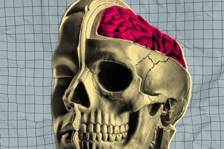 Illustration of a man's head with a cross-section revealing his skull and a further cross-section revealing a portion of his exposed brain. Treated in an off-set screenprint style.