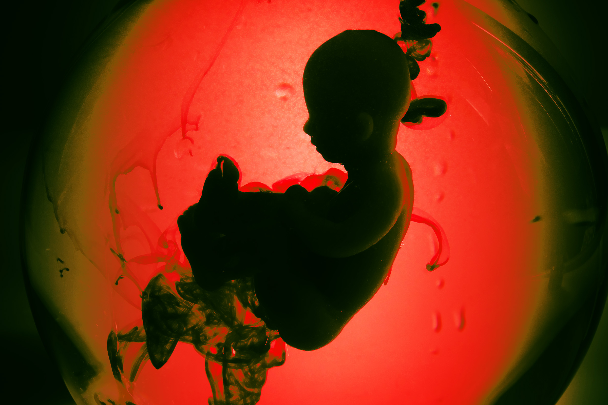 futurism.com - Victor Tangermann - Scientists Concerned Latest Gene Editing of Human Embryos Could 'Open the Floodgates'