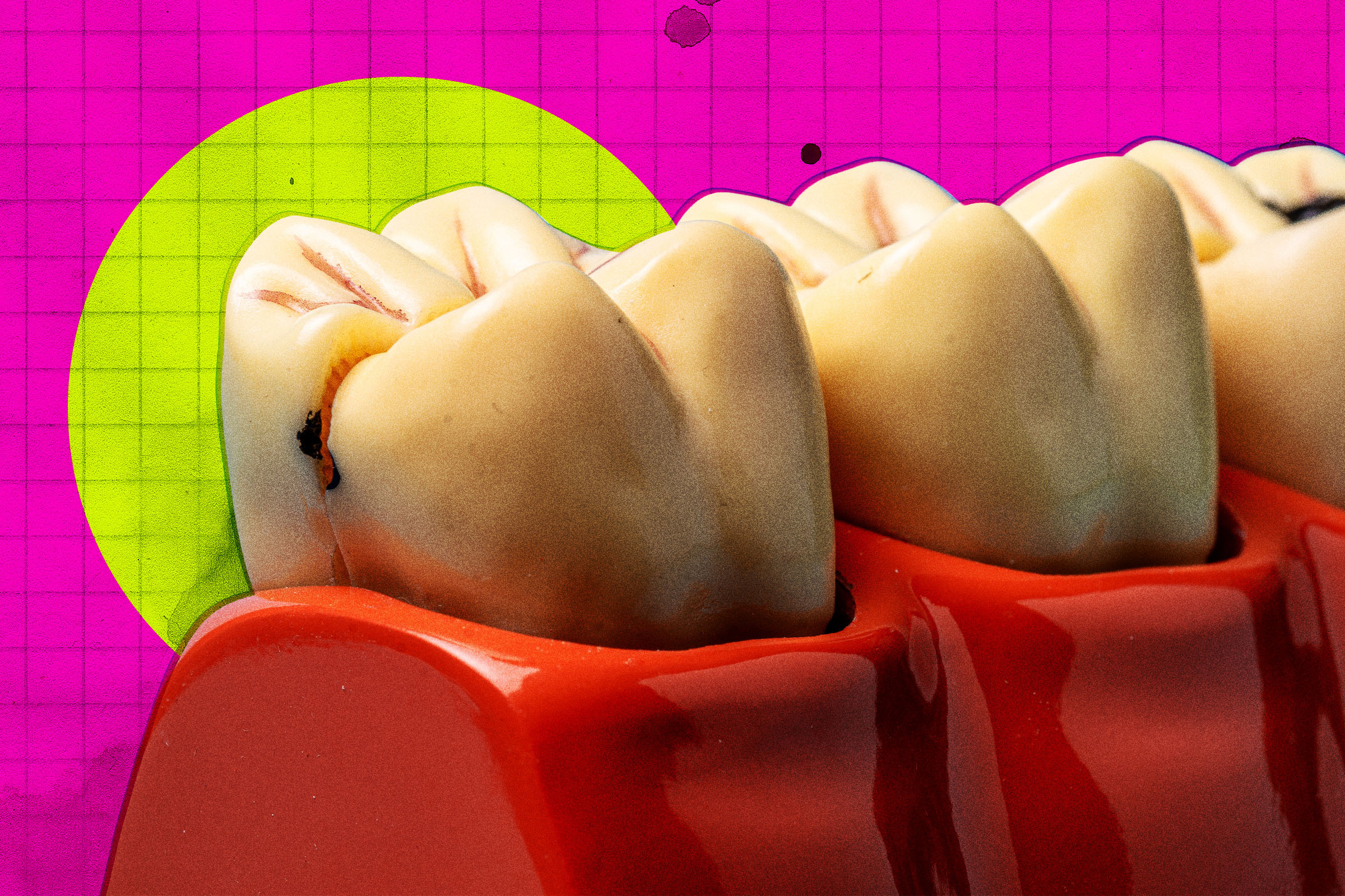 Plans Accelerated for Human Trials of Tooth Regeneration