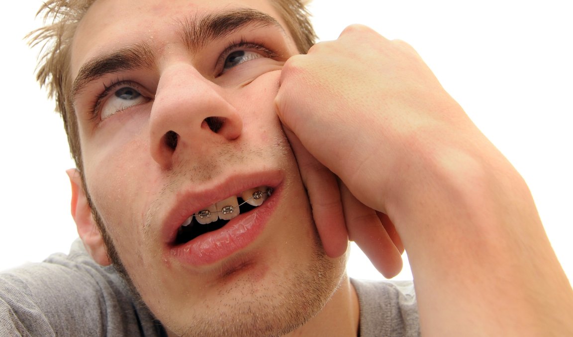 A stock photo shows a young man with braces on his teeth, resting his face on his hand.