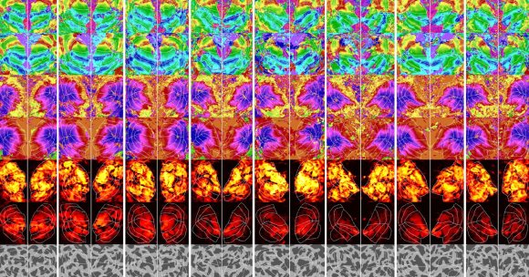 Brain scans used to determine what somebody's imagining in their head.