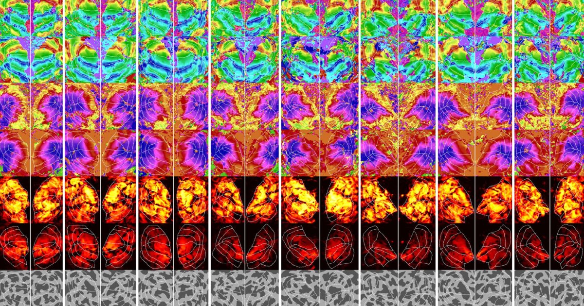 New AI Can Figure Out What You're Thinking About From a Brain Scan